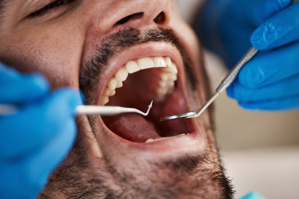 Best Cosmetic Dentistry  in Caldwell, OH